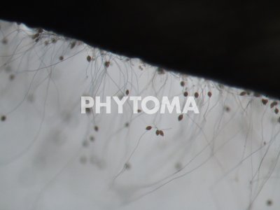 Phytophthora cinnamomi